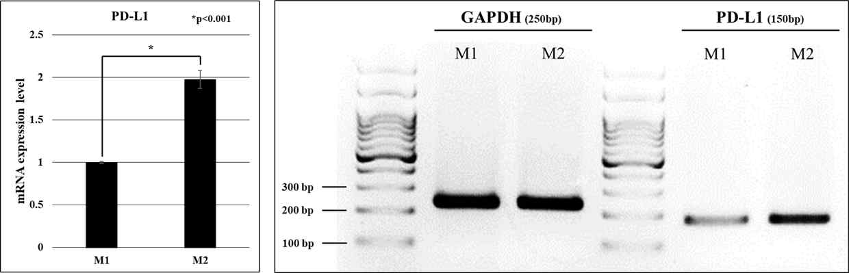 M1, M2 대식세포로 분화 유도된 THP-1의 PD-L1 mRNA 발현 확인 PCR 및 전기영동 결과