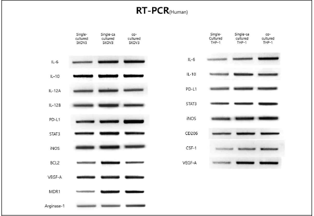 공동배양/Carboplatin 처리 후 Human 난소암 세포주와 대식세포의 RT PCR 결과