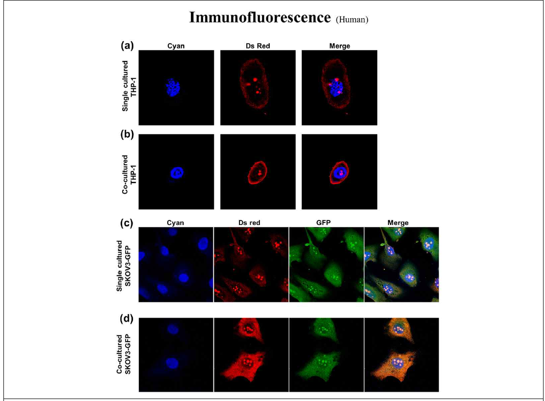 공동배양 전, 후 Human 난소암 세포주와 대식세포의 Immunofluorescence 결과