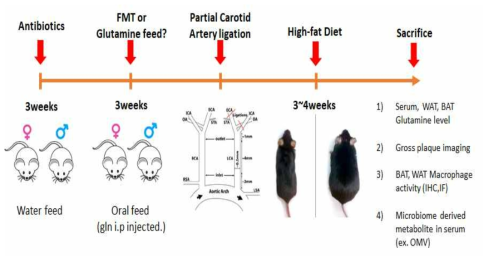 FMT(Fecal Microbiota Transplant; 분변이식술)