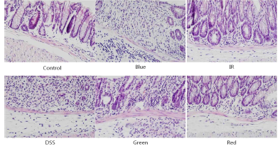 광치료 파장에 따른 대장 조직 H&E 염색 결과