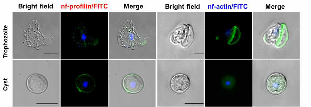 Confocal microscopy로 관찰한 영양형 및 포낭형의 파울러자유아메바의 profilin과 actin의 아메바 내 발현양상.