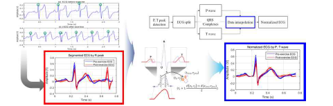 정규화된 심전도의 P, QRS Complexes, T