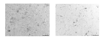 배양된 hMSCs (좌)와 연골세포 (우)