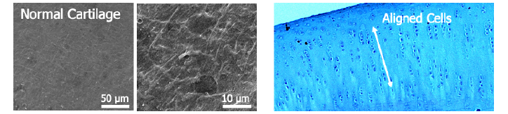 실제 건강한 연골 조직의 표면 (좌)과 단면 (우)