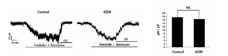 정상군과 임신성 당뇨 환자군에서 forskolin과 adenosine의 처리 후 KATP 전류의 비교