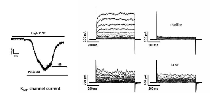 인체 유래 태반동맥 혈관 평활근 세포에서 기록한 KATP (좌), BKCa, Kv 채널 current