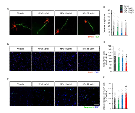 나노플라스틱에 의한 비정상적 신경발 달 및 세포사멸 증가 확인 (A, B) 1차 뇌 신경 세포에 나노플라스틱 5, 10, 50 ug/mL을 처리 하여 신경세포의 형태학적 변화 확인. (C, D) BrdU assay을 통해 신경세포의 증식 확인. (E, F) cleaved caspase-3 염색을 통해 세포사멸 확인