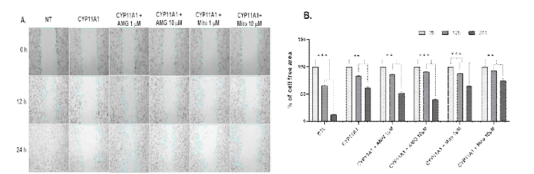 Wound-healing assay. (A) Caki-1 cells were transfected with CYP11A1 and then treated with 1 and 10 μM of aminoglutethimide (AMG) and mitomycin C (Mito). The wound area at 0 h was set at 100% and was subsequently measured at 12 and 24 h of treatment. Multiple images were collected and analyzed using the ImageJ software. (B) Histogram showing % of cell-free regions