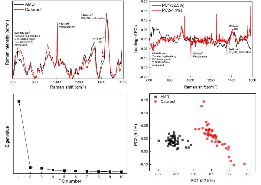 신호처리 후 AMD-Cataract 두 그룹 간 라만분광신호 비교(左上), Raman shift에 따라 두 그룹 사이의 라만분광신호 차이에 대한 가중치 profile(右上), 주성분(PC)의 두 그룹 분류 영향력 분석을 위한 eigenvalue(Scree plot)(左下), 두 그룹 주성분에 의한 cluster plot(右下)