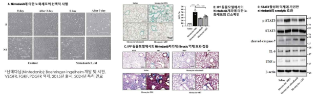 Nintedanib에 의한 노화세포의 선택적 사멸 유도