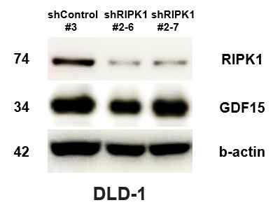 RIP1에 의한 GDF15 발현 조절