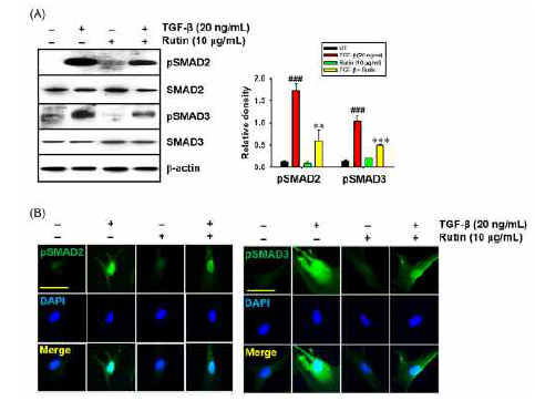 TGF신호전달 억제