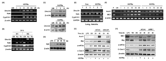 결핵균 감염에 의한 스테로이드 생합성에 관련된 분자들의 mRNA 및 단백질 발현