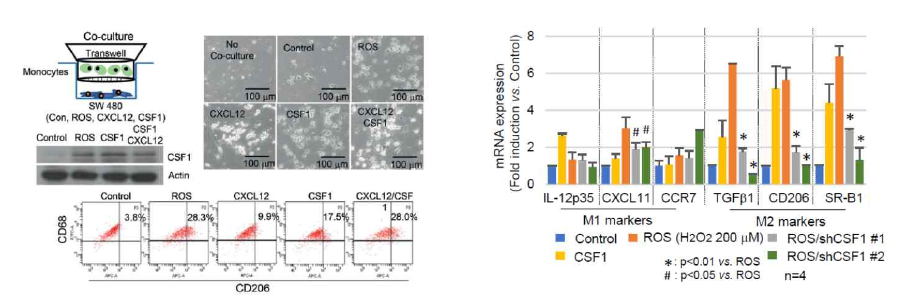 CSF1에 의한 in vitro에서 대식세포 분화 연구
