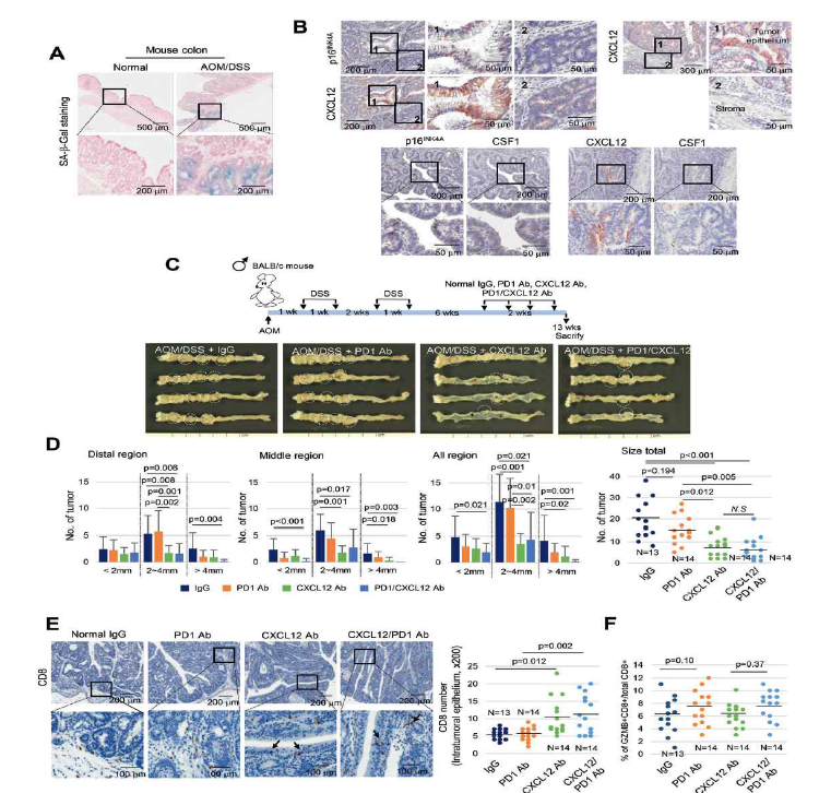 AOM/DSS 마우스 대장암 모델에서 CXCL12 중화항체에 의한 대장암 억제 연구