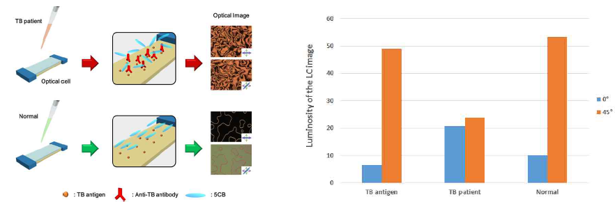 액정 면역 센서칩을 이용한 결핵진단