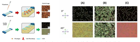 혈청을 이용한 액정 결핵 검사법(좌) 과 액정 이미지(우)