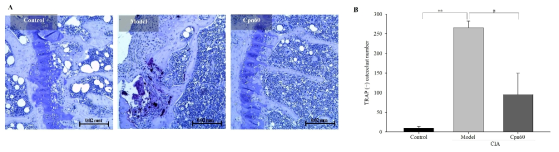 Effect of CPN60 on osteoclast differentiation in CIA mice. (A) Representative images of TRAP staining (magnification × 100, scale bar = 0.02 mm). (B) and the number of TRAP+ osteoclasts. TRAP staining was performed on the knee joint section and stained osteoclasts were counted. Data indicate the mean ± SEM and were analyzed by one-way ANOVA/Tukey’s HSD method. **p < 0.01 vs. control group; #p < 0.05 compared vs. model group