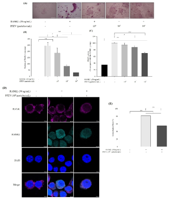 Inhibitory effects of PFEVs on RANKL-induced osteoclast differentiation. TRAP staining (100×, scale bar = 100 μm) (A), number of osteoclasts (B), and TRAP activity (C). After double immunofluorescence staining of RANK and RANKL, high magnification images of RAW 264.7 cells were taken with Leica TCS SP8 X (4,000×, scale bar = 2.5 μm) (D). RANK and RANKL colocalization rates were analyzed with Leica LAX software (E). The values indicate the mean ± SD of three independent experiments. One-way ANOVA/Tukey’s HSD analysis was performed. **p < 0.01 and ***p < 0.001 compared with the control group; #p < 0.05 and ###p < 0.001 compared with the RANKL-only-treated group