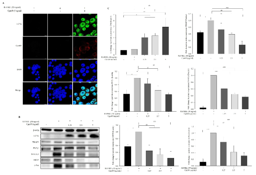 Effect of CPN60 on the expression levels of LCN2 and proteins related to osteoclast differentiation. RAW 264.7 cells were treated with RANKL (50 ng/mL) with or without CPN60 for 4 days. (A) Representative images of double immunofluorescence staining of CPN60 and LCN2 observed using confocal microscopy (scale bar = 10 μm). (B, C) Expression levels of the proteins related to osteoclast differentiation measured using western blot (B) and quantified (C). The data represent the mean ± SD of three independent experiments. *p < 0.05, **p < 0.01, and ***p < 0.001 vs. Control group; #p < 0.05, ##p < 0.01, and ###p < 0.001 vs. RANKL-only treated group