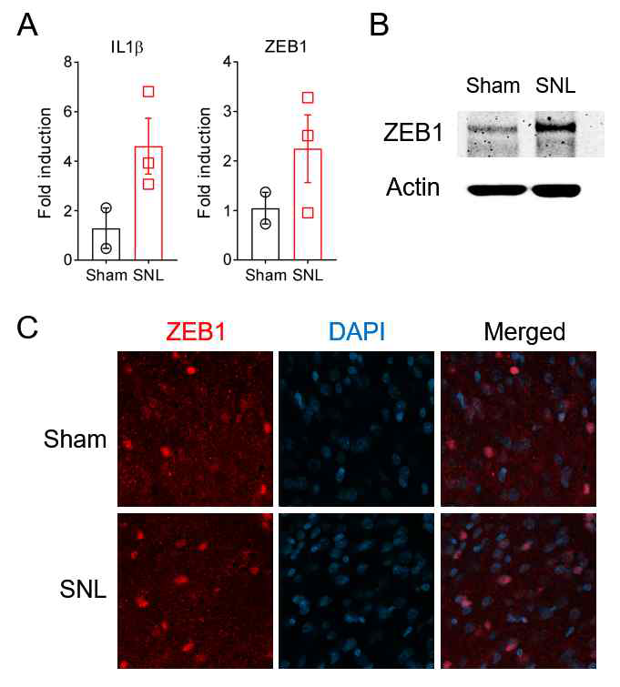 Sham과 SNL모델에서 ZEB1의 발현 비교