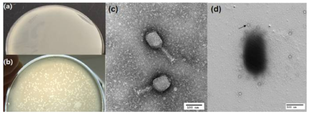 박테리오파지 분리 및 현미경 관찰