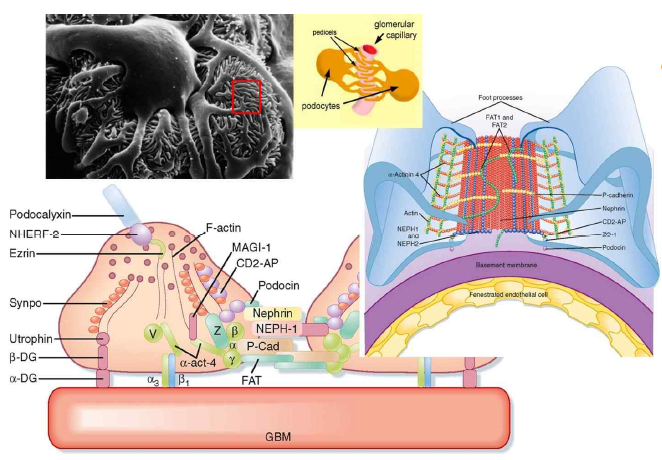 신장 사구체의 podocyte slit diaphragm 모식도