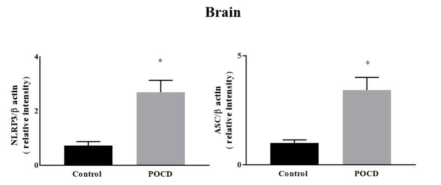 POCD 동물모델의 fecal에서 NLRP3 pathway 연관 단백질 발현이 높아짐을 확인