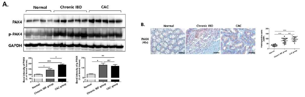 염증성장질환 및 염증유도 대장암 동물모델의 대장 조직에서 PAK4 발현 상승 확인. DSS 또는 AOM/DSS 유도 만성염증 및 염증 유도 대장암 동물모델을 확립하여 장조직내 PAK4 단백질 발현 양상을 비교 분석한 결과 약 2배의 PAK4 단백질 발현 상승과 약 2.7배의 PAK4 활성화를 염증성장질환 동물모델에서 확인. 또한 염증 유도 대장암 모델의 장조직에서는 정상조직 대비 약 3배와 2.6배의 PAK4 단백질의 발현 상승과 활성화를 확인하였음. 이를 통해 염증 유래 대장암 표적 마커로써의 가능성을 규명