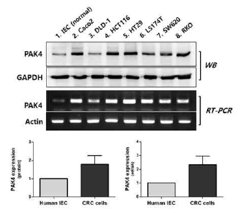 세포주를 이용한 PAK4 발현 양상 분석과 염증 사이토카인 IL-4에 의한 대장암세포의 PAK4 발현 상승 유도. 사람 장상피세포 (IEC)와 7종류의 사람대장암세포주의 단백질과 mRNA 발현을 비교분석함. 그 결과 정상 세포에 비해 월등히 높은 수준의 PAK4 발현 상승을 확인하였음