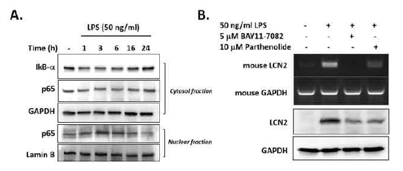LPS 처리에 따른 LCN2 발현 상승과 NF-kB 기전 관계 규명. 대식세포에 LPS를 처리하고 NF-kB 활성의 변화를 관찰하고 NF-kB활성 억제제를 이용하여 LCN2 발현 변화를 확인. 이로써 LPS에 의한 LCN2 발현은 NF-kB 활성에 의존적임을 증명하였음
