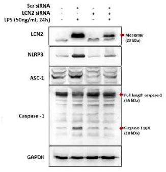 LPS-유도 LCN2에 의한 inflammasome (염증조절복합체) 형성 조절. 마우스 대식세포에 LCN2 siRNA를 transfection 시킨 후 LPS를 처리하고 24시간 inflammasome 형성 정도를 평가. 그 결과 inflammasome 복합체의 구성 molecule인 NLRP3, ASC-1, caspase-1 단백질 발현 조절을 확인함. LPS에 의해 촉진된 inflammasome 형성이 LCN2 siRNA에 의해 감소됨을 확인하여 LCN2가 염증조절복합체를 조절에 관여함을 규명