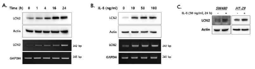 사람 대장암 세포에 염증 사이토카인인 IL-6 투여 후 LCN2 발현 변화 확인. 그 결과 사람 대장암 세포주에서 IL-6의 농도와 처리시간에 의존적으로 LCN2 단백질 및 mRNA 발현 상승을 규명