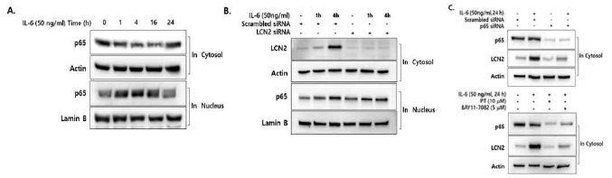 IL-6 유도 LCN2 발현과 NF-kB 활성 기전과 관계 규명. IL-6에 의한 LCN2 발현 조절 기전을 규명하기 위하여 NF-kB 활성 양상을 확인하고 siRNA와 NF-kB 활성 억제제를 사용하여 LCN2 발현의 변화를 확인. 그 결과 IL-6 유도 LCN2의 발현이 NF-kB 활성에 의존적으로 조절되며 NF-kB 활성 기전이 LCN2의 발현을 조절하는 상위조절자이며 LCN2를 조절하는 전사인자임을 예측