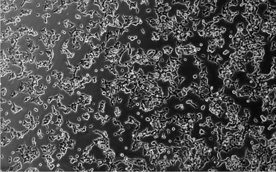 (좌). ACE2-HEK293 cells