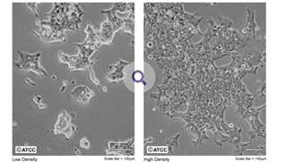 (우). ATCC사이트의 HEK293 cells