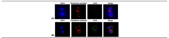 Confocal fluorescent microscopy images with anti-CD41 antibody (1:100) for SKOV-3 cell. (A), PTX-NLC; (B), P-PTX-NLC (blue= nuclear, red = F-actin, green = CD41).