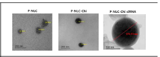 Transmission electron microscopy images of P-NLC, P-NLC-Chi and P-NLC-Chi-siRNA.