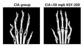 micro-CT 결과