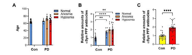파킨슨 환자의 콧물액 내 a-synuclein PFF에 대한 결합력을 가진 IgG의 증가. (A) 콧물액 샘플을 채취한 healthy control (Con 20), 파킨슨 환자군 (PD, 32)에 대한 연령 분포. PD군은 정 상 후각, 후각 감소, 후각 소실군 (normal 8; hyposmia 17, anosmia 7)으로 각 구분함. (B, C) 정상군 및 정 상, 후각 감소, 후각 소실 증상을 보이는 파킨슨 환자군으로부터 채취한 콧물액에 대해서 α-synuclein PFF 항원에 대한 결합력을 보이는 콧물액 항체의 수준을 ELISA를 통해 측정하여 막대 그래프로 표현함. 패널 (B) 정량값에 대해서 정상군과 파킨슨 환자군으로 구분하여 막대그래프로 표현함