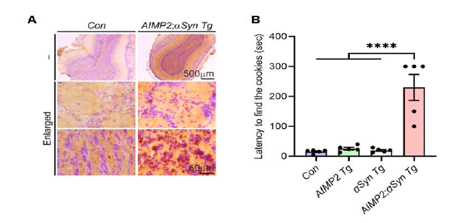 파킨슨병 마우스의 후각 장애 유도. (A) 신규 파킨슨병 모델인 AIMP2/αSyn Tg 마우스의 후 각 망울에서의 루이소체 병변 유도를 pS129-αSyn 특이 항체를 이용한 면역 조직 염색 이미징으로 확인. (B) 후각 기능 행동 실험인 hidden cookie test에서의 성공 달성 시간 정량 그래프 (2.5 개월 령)