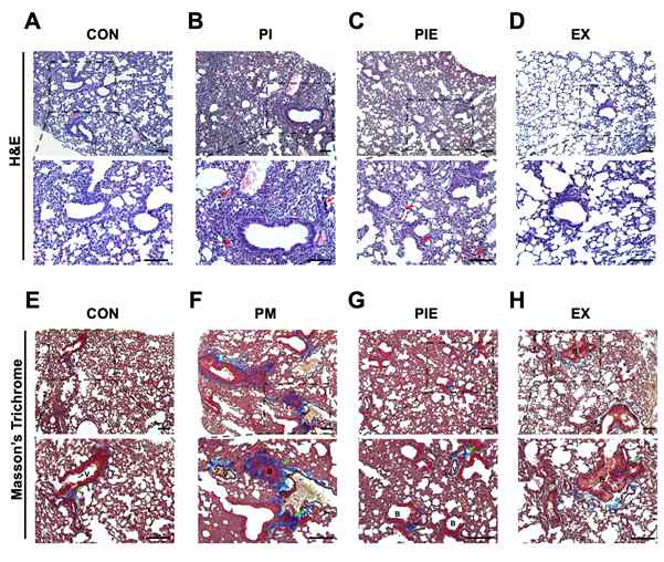 Histochemical and biochemical analyses of the lung fibrosis (A-D) H&E straining of the lung tissue sections. Red arrows indicate infiltration of the inflammatory cells (neutrophils in alveoli). (E-H) Masson’s trichrome staining of the lung tissue sections, with collagen fibers as blue. (I) Quantification of the collagen fibers observed in Masson’s trichrome stained lung tissue sections. Values are the means ± SEM (n=3). ***P< 0.001 vs. CON, ##P<0.01, &P<0.05vs. PIE vs. PI.