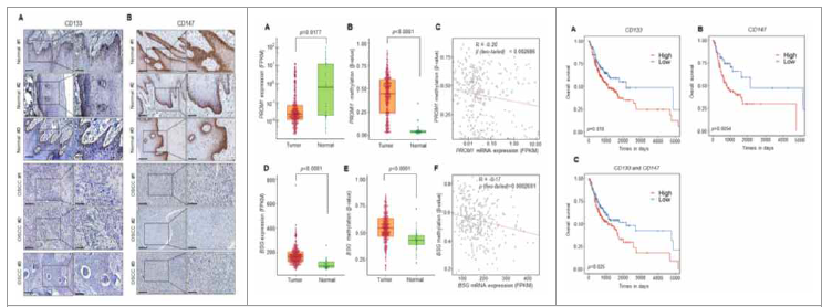 (좌) 정상 조직과 구강암 환자 조직 샘플에서 CD133, CD147 유전자 단백질 발현 패턴 비 교 (중) HNSCC TCGA database에서 primary OSCC tumors (n = 338)에서의 CD133, CD147의 유전자의 전사적 발현 패턴, DNA methylation 변화 분석 및 이들의 상관관계 분석 결과 (우) HNSCC TCGA database에서 primary OSCC tumors 환자에서 CD133과 CD147 유전자 methylation을 이용한 Overall survival 분석 결과 (Han and Park et al., Int. J. Mol. Sci. 2022, 23, 14624)