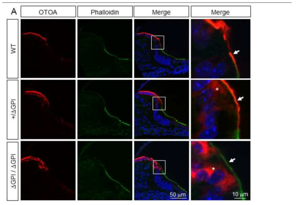 Airyscan fluorescence immunohistochemistry를 이용해서 GPI-anchor 부분 sequence만 제거한 Otoa△GPI allele을 확인함. heterozygote에서는 cell membrane에도 이동하였으나 cytoplasm에 retain 되기도 하였으나, homozygote에서는 아예 모두 cytoplasm에 retained. ==>Otoa의 기능 더 나아가 난청을 일으키는 기전에서 GPI anchor가 중요한 역할을 함을 확인함