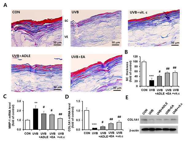 UVB 조사 Labcyte EPI 피부 모델에서 Masson‘s trichrome 염색된 조직 및 노화인자 발현의 변화