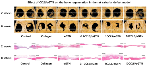 Rat calvarial model 실험 결과; 고농도(10ug/ml)의 CCL5를 전기방사하여 CCL5/eGTN를 제조하고 이식하였을 때에도 골재생이 증가되는 것을 확인하였음