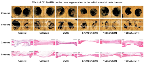 Rabbitt calvarial model 실험 결과; 중농도(1ug/ml)와 고농도(10ug/ml)의 CCL5/eGTN에서 골재생이 증가되는 것을 확인하였음