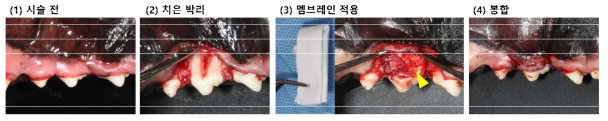 시작품(prototype)“ CCL5탑재된 eGTN(CCL5/eGTN)“을 성견의 자연 치아에서 dehiscence defect model에 이식하여 치주 조직 재생 효과를 분석하였음
