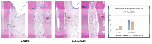 CCL5/eGTN의 치주 조직 재생 효과 ; 조직학적 분석에서 CCL5/eGTN은 new cementum 재생을 향상시키고 치조골을 유의하게 향상시킴을 확인함